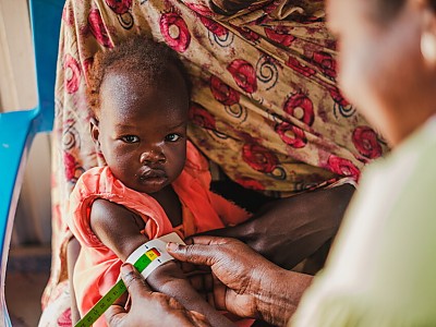 월드비전, 남수단 콜레라 위기에 긴급구호 시작